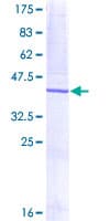 Human DUSP3 / VHR Protein (Recombinant GST)