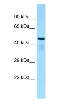 C6orf134 / ATAT1 Antibody (aa251-300)