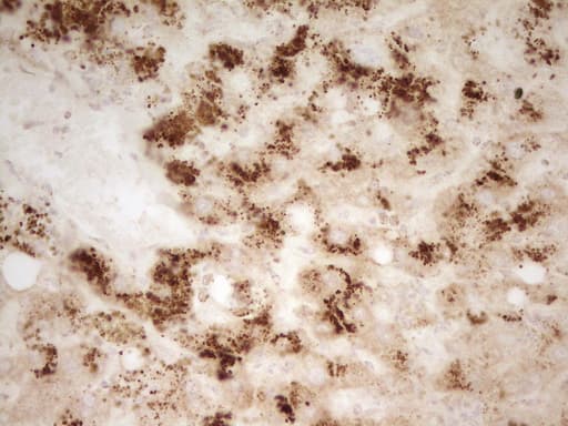 MRRF Antibody (aa56-262, clone OTI1D5, Carrier-free)