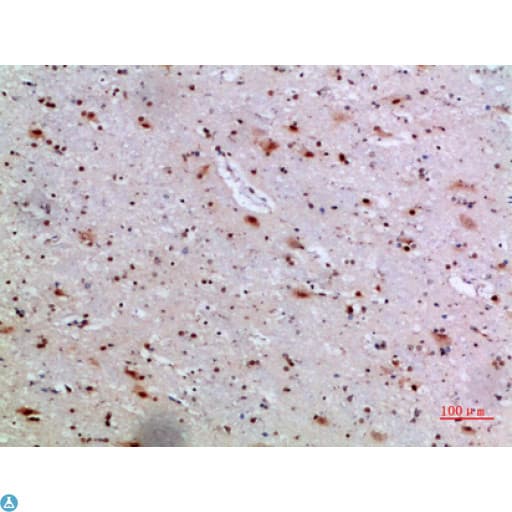 IL36A Antibody