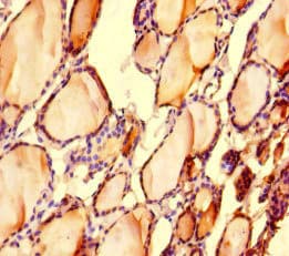 LONP1 / LON Antibody