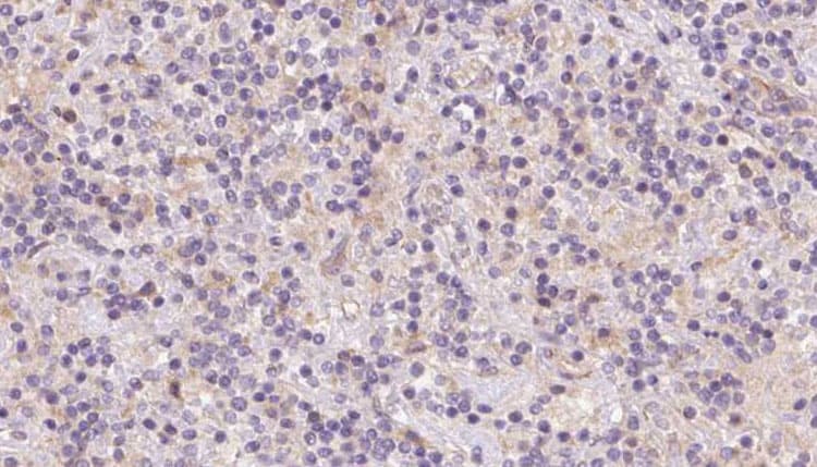TOMM40 / TOM40 Antibody