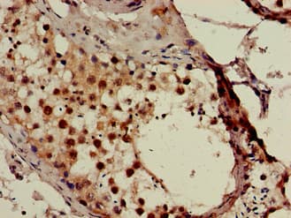 SMN1 Antibody
