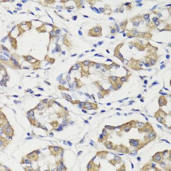 DEPTOR / DEPDC6 Antibody