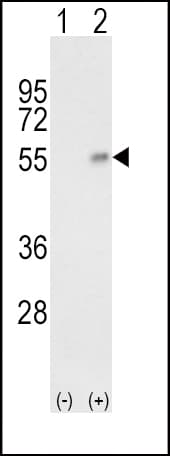 PathPlus™ HP / Haptoglobin Antibody (aa295-322)