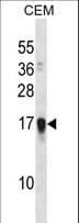 NDSP / FAM163A Antibody (aa32-61)