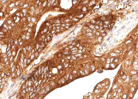 CTSE / Cathepsin E Antibody
