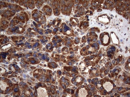 Monoclonal Mouse anti-Human NCR2 / NKP44 Antibody (clone OTI4B8, aa44-190, IHC, WB)