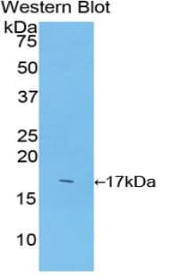 SOD1 / Cu-Zn SOD Antibody (aa2-152)
