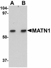 IHC-plus™ MATN1 / Matrilin 1 Antibody