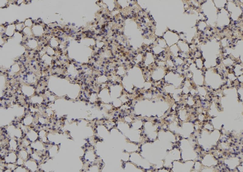 Polyclonal Rabbit anti-Human PAX1 Antibody (IHC, WB)