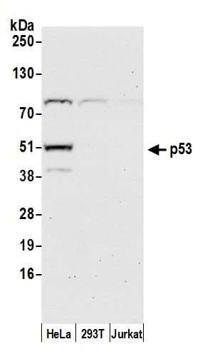 TP53 / p53 Antibody (aa375-C-term)