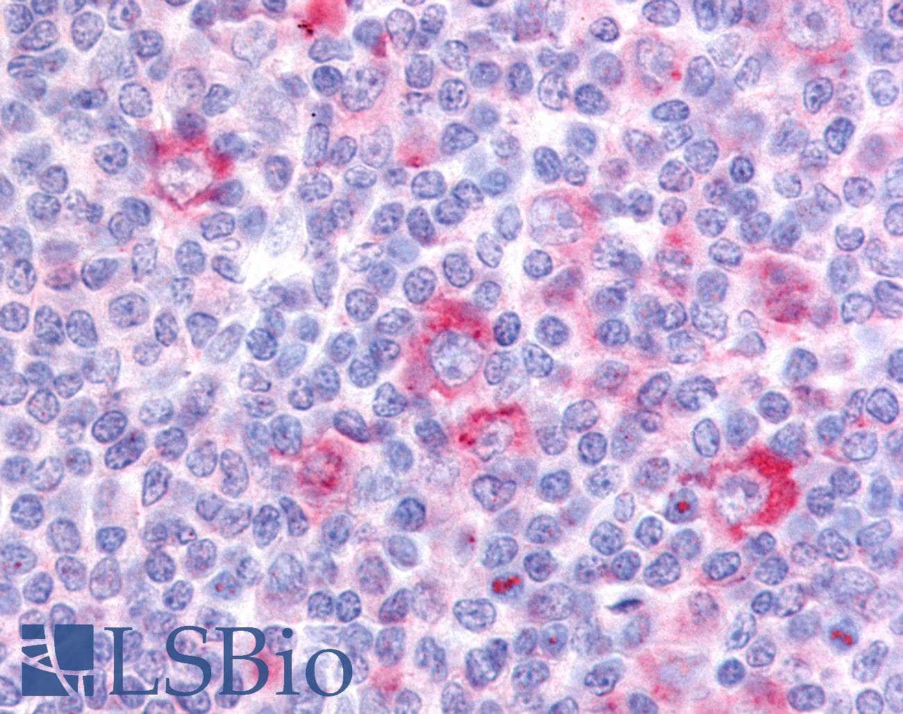 IHC-plus™ Polyclonal Rabbit anti-Human GPR62 Antibody (C-Terminus, IHC)