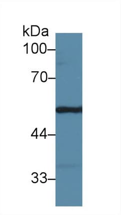 FGG / Fibrinogen Gamma Antibody (aa168-405, PE)
