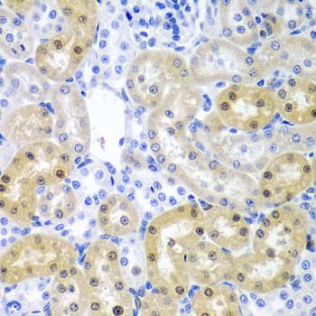 ADAD1 Antibody