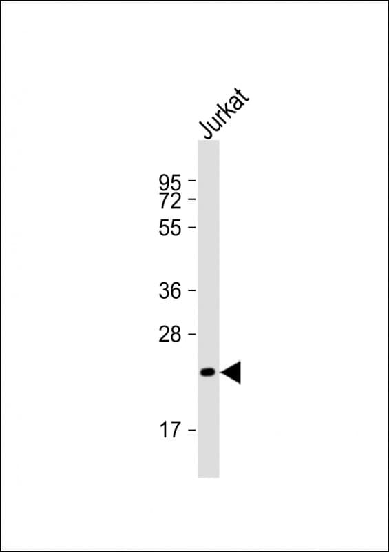 Polyclonal Rabbit anti-Human FGF6 Antibody (aa102-134, WB)