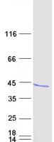 Human RCAN3 / Calcipressin 3 Protein (Recombinant Myc-DDK (Flag))
