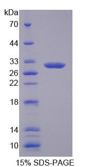 Human SLC25A12 / ARALAR Protein (Recombinant His, N-Terminal)