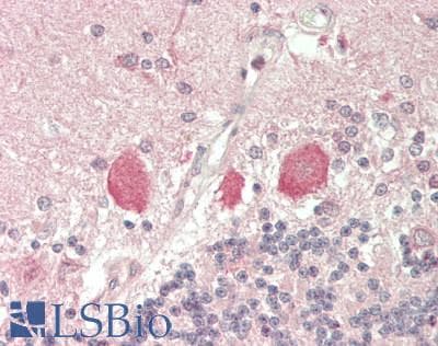 PathPlus™ Polyclonal Rabbit anti-Human TAC3 / Tachykinin Antibody (IHC, IF, WB)