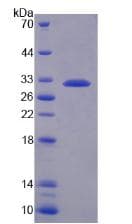 Mouse CFI / Complement Factor I Protein (Recombinant His)