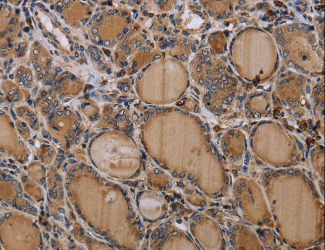 Polyclonal Rabbit anti-Human NALP4 / NLRP4 Antibody (IHC)