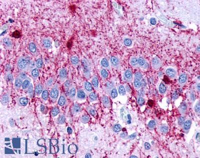 PathPlus™ Polyclonal Rabbit anti-Human DRD4 / Dopamine Receptor D4 Antibody (C-Terminus, IHC)