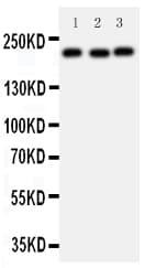 TP53BP1 / 53BP1 Antibody (aa1955-1972)