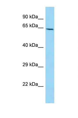 NUMB Antibody (C-Terminus)