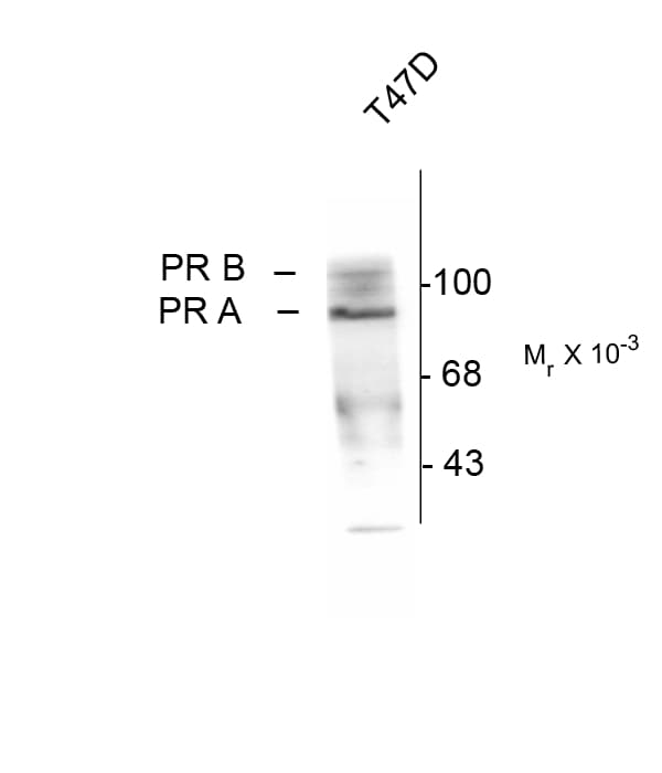 Monoclonal Mouse anti-Human PR / Progesterone Receptor Antibody (phospho-Ser190, IHC, WB)