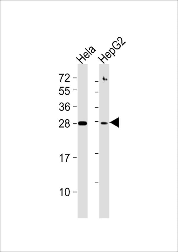 SIP / TP53INP1 Antibody