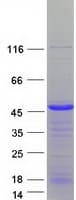 Human SLBP Protein (Recombinant Myc-DDK (Flag))