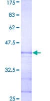 Human STC1 / Stanniocalcin Protein (Recombinant GST, N-terminus)
