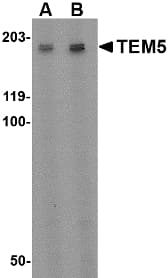 ADGRA2 / GPR124 Antibody