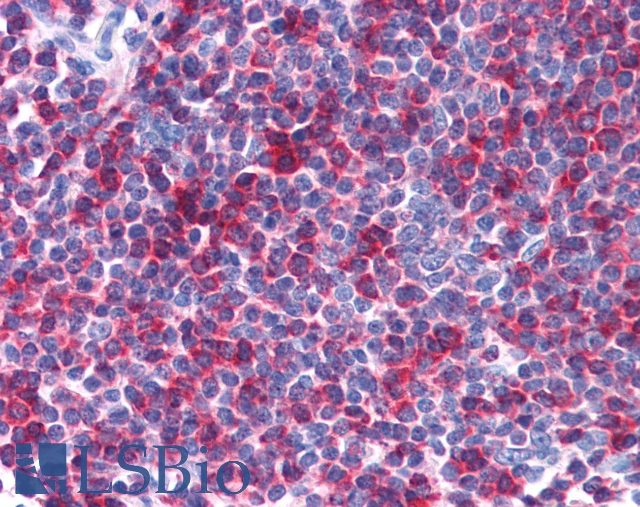 IHC-plus™ SH3BP1 Antibody (aa689-701)