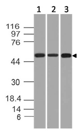 Monoclonal Mouse anti-Human KRT76 / Keratin 76 Antibody (WB)