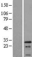 PCNP Protein (Over-Expression Lysate Myc-DDK (Flag))