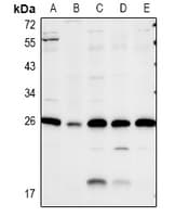 CAV2 / Caveolin 2 Antibody