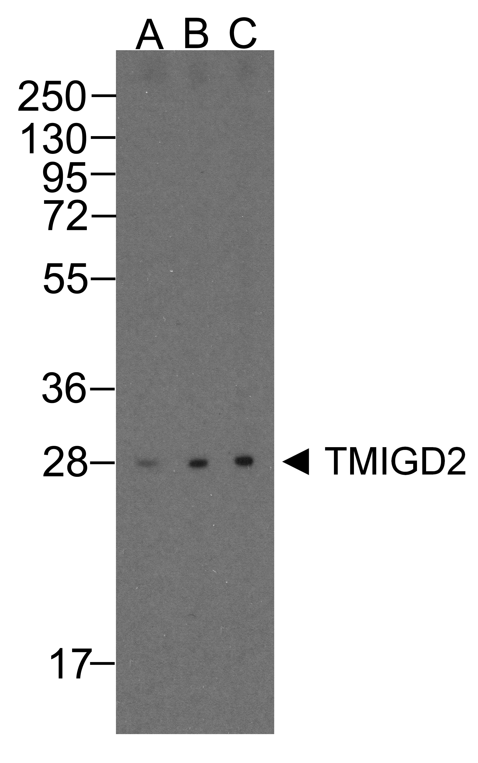 PathPlus™ TMIGD2 Antibody (clone 8G1)