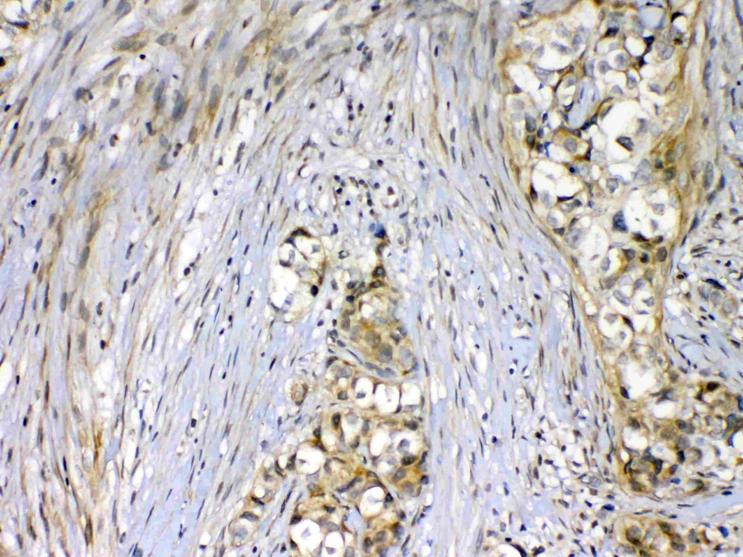 KDR / VEGFR2 / FLK1 Antibody