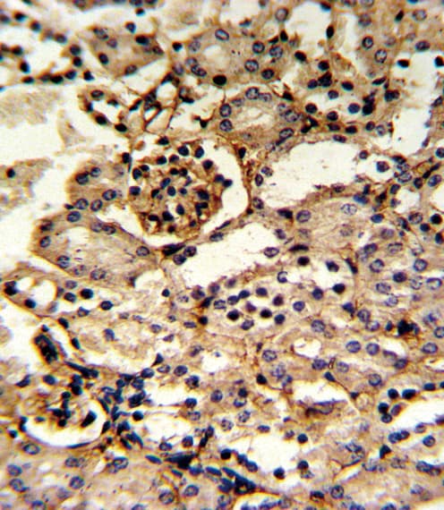 GMPS / GMP Synthase Antibody (aa296-325)