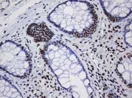 DCPS Antibody (clone OTI1E6)