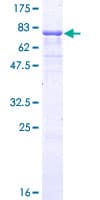 Human Vitamin D Receptor / VDR Protein (Recombinant GST)