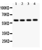 Polyclonal Rabbit anti-Human SYNCAM / CADM1 Antibody (aa45-340, WB)
