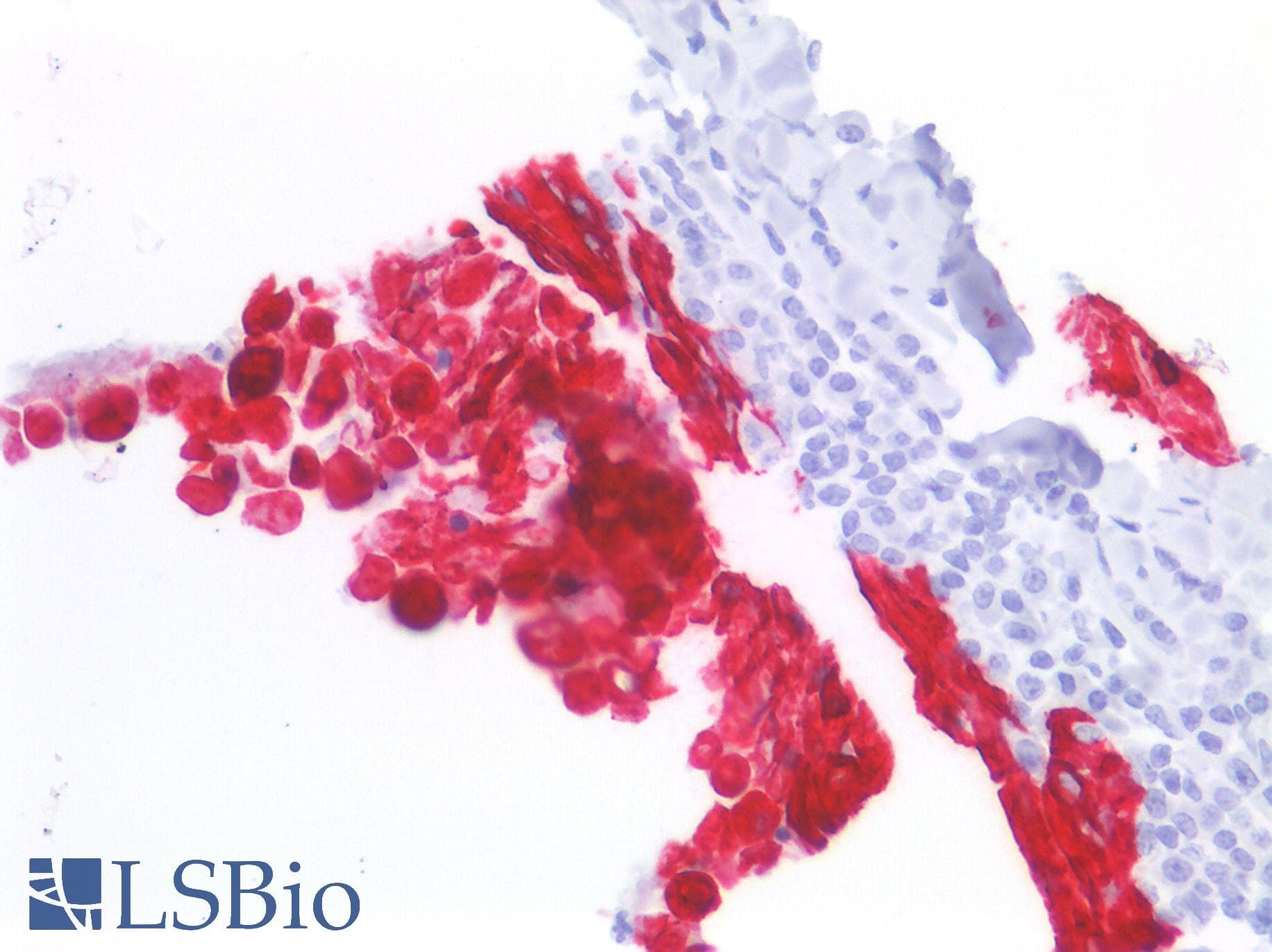PathPlus™ Monoclonal Mouse anti-Human KRT13 / CK13 / Cytokeratin 13 Antibody (clone 1C7, IHC, WB)