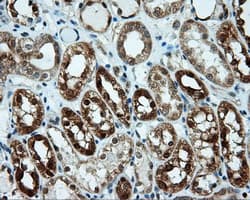 LIPG / Endothelial Lipase Antibody (clone OTI7C2)