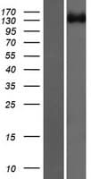 ROBO2 Protein (Over-Expression Lysate Myc-DDK (Flag))