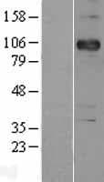 CDH3 / P-Cadherin Protein (Over-Expression Lysate Myc-DDK (Flag))