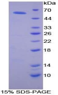 Mouse ALCAM / CD166 Protein (Recombinant His-T7)