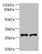 TREM2 / TREM-2 Antibody