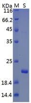 Coronavirus SARS-CoV-2 ORF3a Protein (Recombinant His)